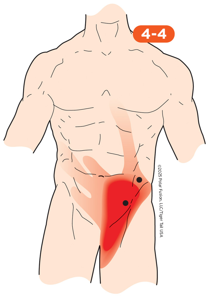 Hip Flexor Pain 4-4 Abdominus Obliqui
