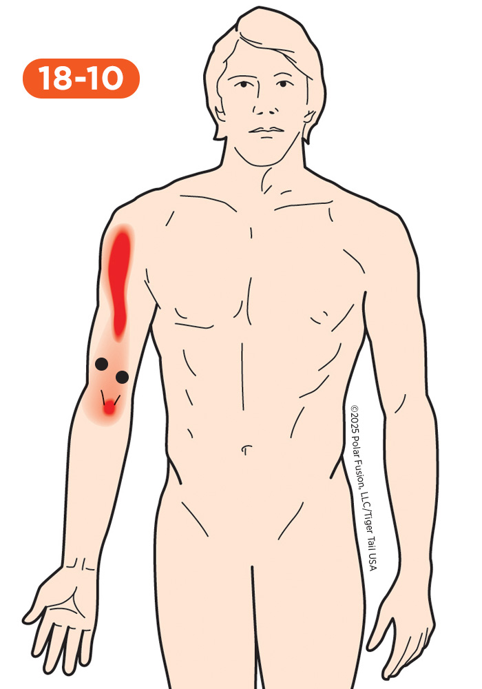 Elbow Pain 18-10 Biceps Brachii